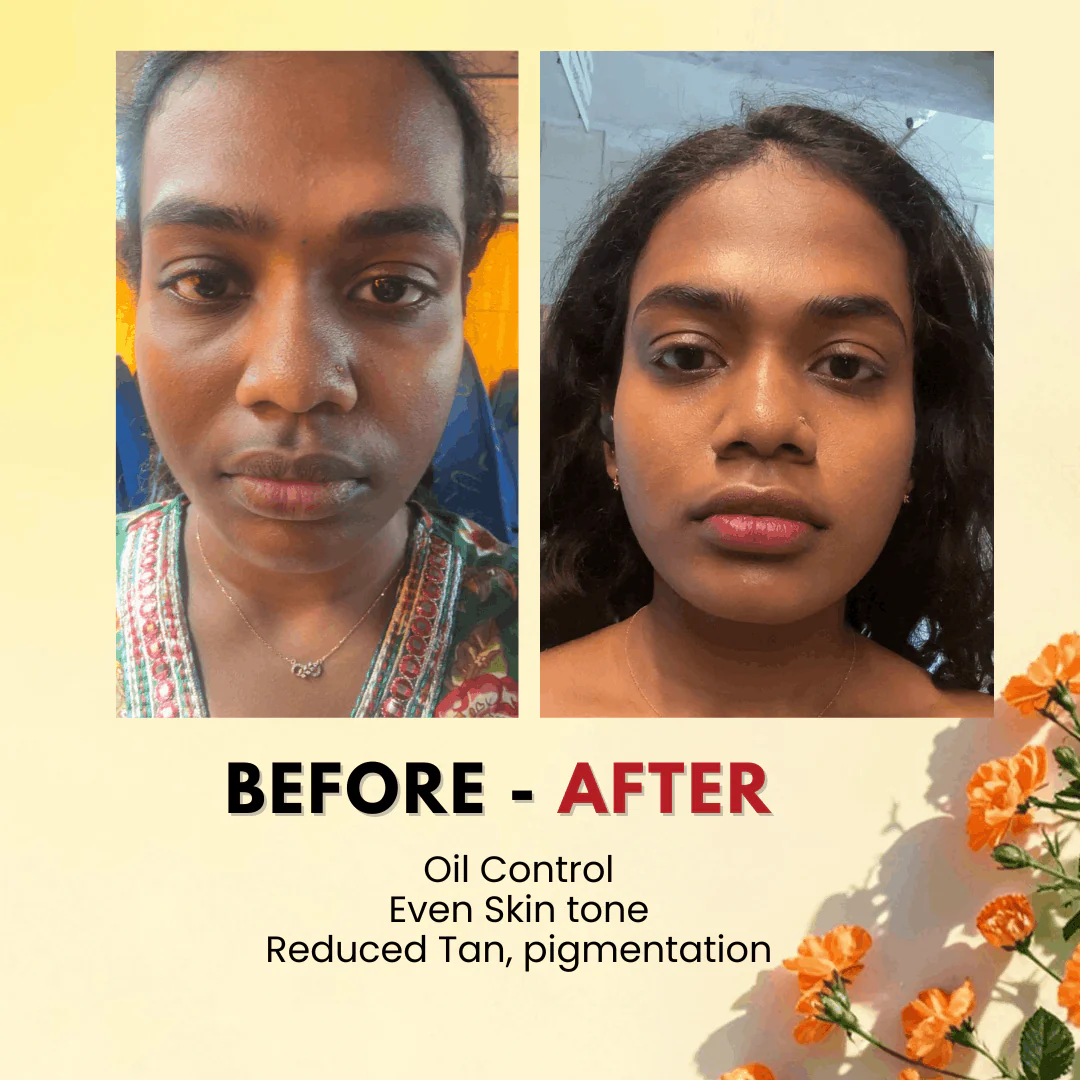 Detan Clay Mask 50 Gms - Image 6